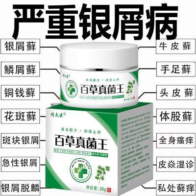 正品真菌王软膏顽固性牛皮癣银屑病皮炎湿疹头藓全身止痒外用药膏