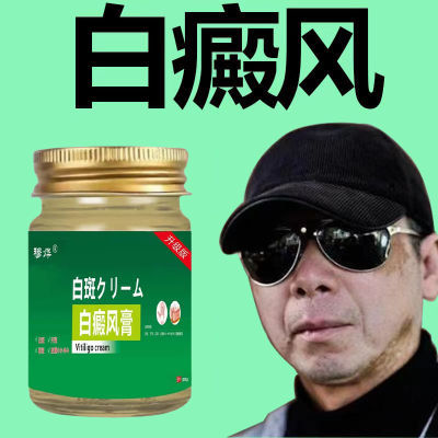 冯导推荐日本白癜风进口药膏化白促黑白斑补骨脂酊外用药皮肤护理