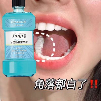 【溶解牙黄石】正品黄牙溶解牙黄口臭口腔清洁牙结石清洁牙垢烟渍