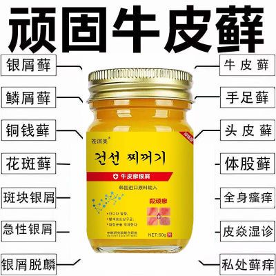 【爆卖200W】韩国进口卡泊三淳软膏顽固性牛皮癣银屑病皮炎湿疹