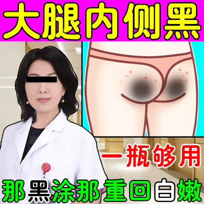 大腿内侧黑【真官用】久坐屁股黑肘部脖子黑棘皮淡化黑色素亮白膏