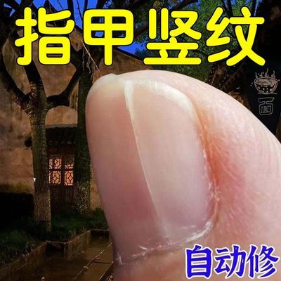 指甲有竖纹【自然修复】有横纹凹凸不平指甲黑线甲床竖纹甲肉分层