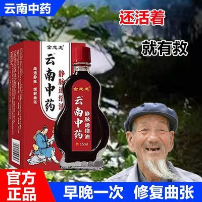 【云南中药】静脉曲张油曲张专用药蚯蚓腿青筋凸起通脉疏络