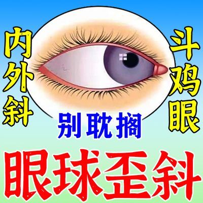 眼睛斜视成人儿童眼球歪斜内斜外斜斗鸡眼看物有重影弱视纠正眼贴