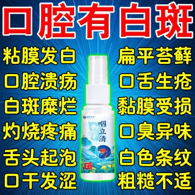 口腔黏膜白斑口腔扁平苔藓口内生疮灼热粗糙网状白斑充血口苦刺痛