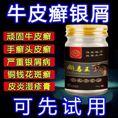 牛皮癣银屑病手足癣头癣湿疹止痒皮肤外用牛皮癣老偏方特效乳膏