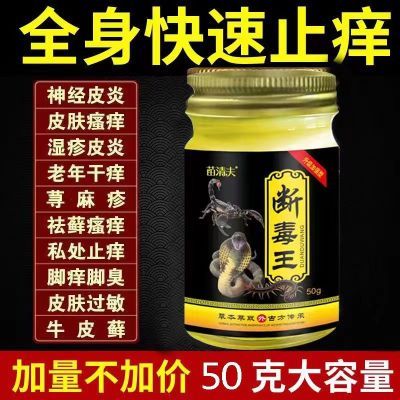 【牛皮癣专用药膏】银屑癣湿疹头癣体癣手足股癣皮肤瘙痒止痒王