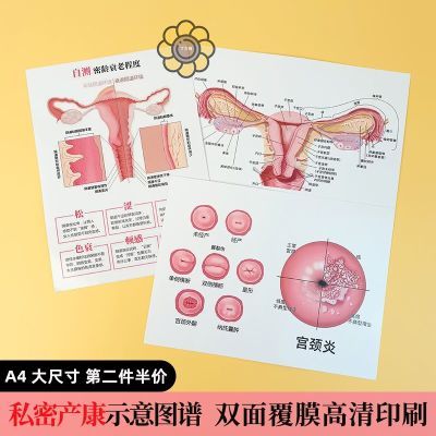 男女性生殖解剖图谱私密产康妇科子宫颈炎盆底肌私处A4宣传纸海