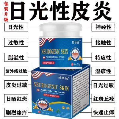 红斑日晒性日光性皮炎紫外线过敏晒伤修复神经性皮炎膏正品老牌子