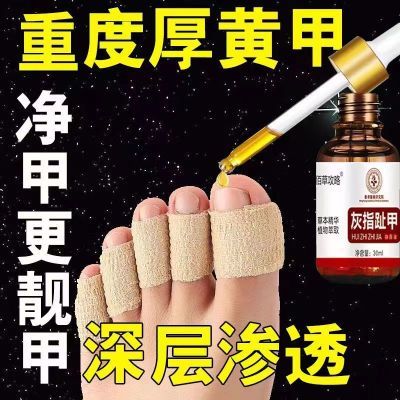 【香港净甲】指甲灰厚趾甲修复抑菌液坏甲空甲甲萎缩甲变色修复液