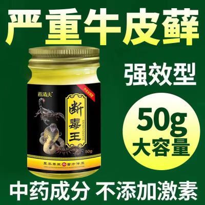 【正品断毒王】牛皮癣银屑癣手足癣头癣体癣湿疹皮炎皮肤瘙痒止痒