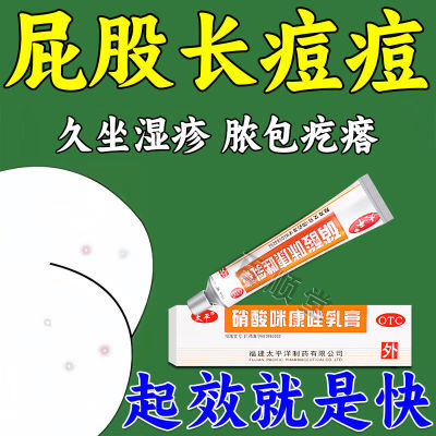 坐板疮乳膏】屁股长疙瘩久坐湿疹痘痘湿疹药膏痤疮药膏硝酸咪康唑