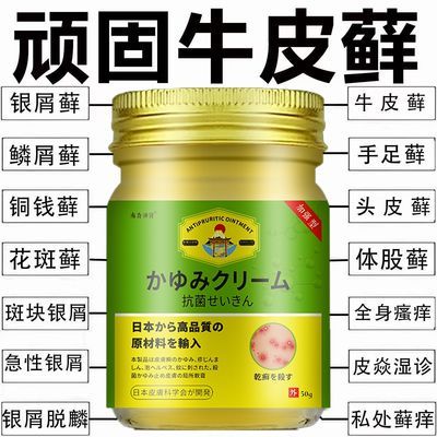 日本进口顽固湿疹皮炎牛皮癣银屑荨麻疹皮肤瘙痒特效抗过敏止痒膏