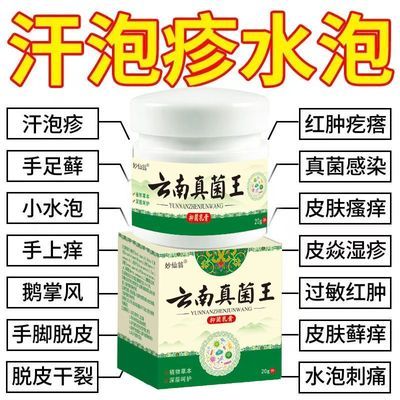 云南真菌王汗疱疹手上起小水泡手足癣真菌感染湿疹水泡脱皮止痒膏