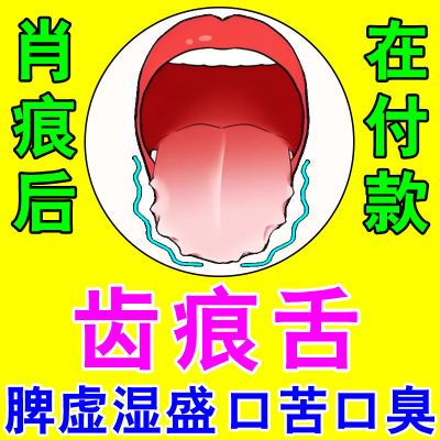 齿痕舌【强校版】口干苦口臭舌炎舌苔白厚有裂纹脾虚湿重调理喷剂