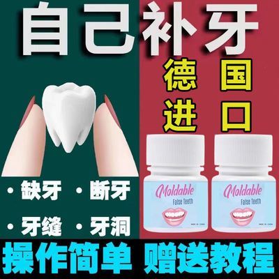 【加硬耐用补牙材料】进口纳米补牙材料树脂补牙填牙洞缺牙牙缝