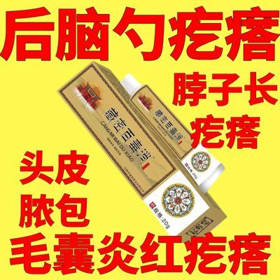 后脑勺疙瘩头部头上头皮脓包脖子后面长疙瘩毛囊炎头部头上红疙瘩