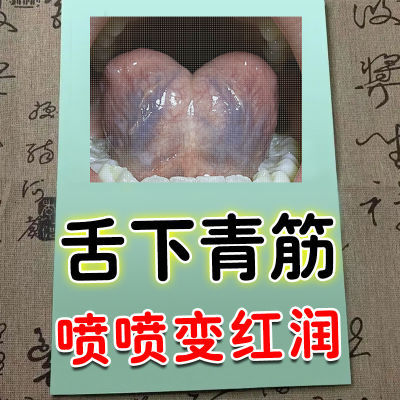 舌下青筋【院线同款】舌根发黑舌下青筋舌根粗大肿痛麻木专用喷剂