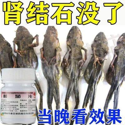 结石药肾结石专用药鸡内金排石化石腹部疼痛恶心呕吐中药颠茄片