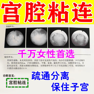 【院线直发】宫腔粘连分离贴小腹酸痛子宫内膜薄月经异常量少调理