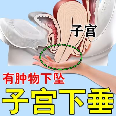 子宫脱出下垂小肉球小腹坠痛月经不调宫寒盆底肌松弛漏尿调宫贴y