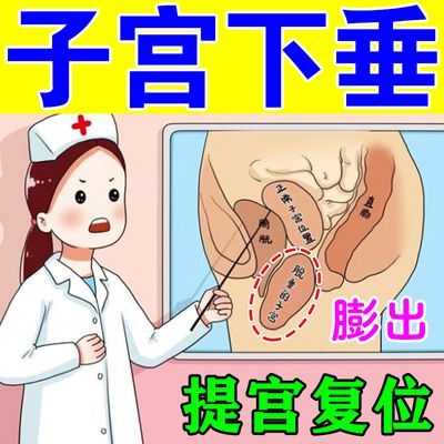 子宫下垂产后下垂脱出漏尿腰腹酸痛中老年子宫膨出盆底肌松弛z