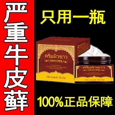 正品保证泰国御灵花白鲜皮抑菌膏白鲜膏牛皮癣官方正品厂家直发