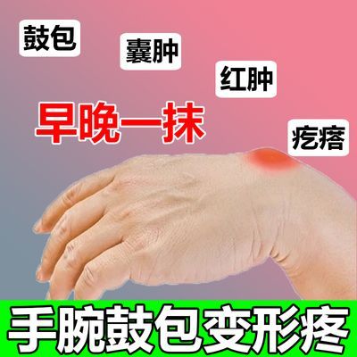 【腱鞘囊肿】手腕有鼓包硬软块疙瘩消脚背腱鞘活血化瘀专用药膏