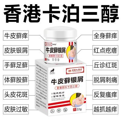 正品卡泊三淳倍他米软膏全身顽固性牛皮癣头癣银屑股癣皮炎止痒膏