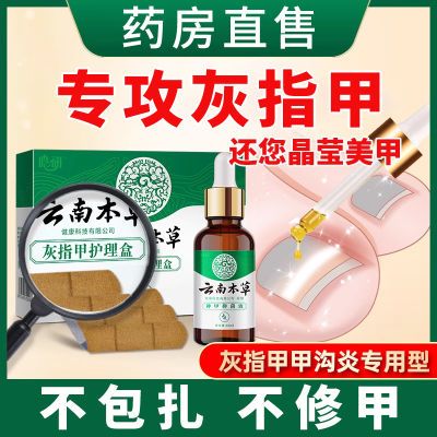 云南本草灰指甲专用抑菌液快速去顽固坏软甲灰甲增厚脱甲甲沟炎