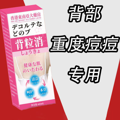 后背祛痘喷雾祛痘印去前胸脖子背部粉刺除螨背上长痘美背男女学生