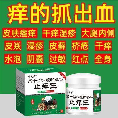 湿疹膏湿疹专用荨麻疹膏牛皮癣皮肤瘙痒皮炎湿毒特效止痒皮肤干