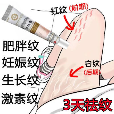 韩国去妊娠纹肥胖纹淡化大腿纹生长纹修复霜孕妇产后预防紧致专用