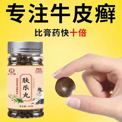 【老偏方】牛皮癣白屑红斑瘙痒干痒正品栀子桃仁非花茶