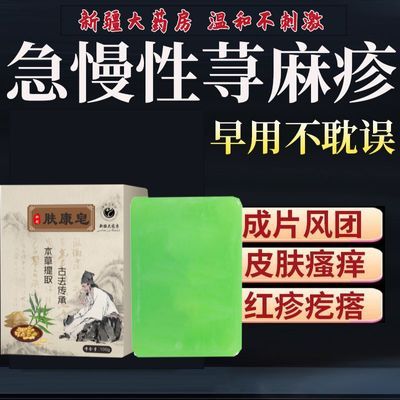 正品中药皂】草本配方皮肤起风团红斑怕风荨麻珍通用型专用老牌子