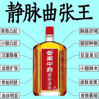 云南中药【静脉曲张】油曲张专用药蚯蚓腿青筋凸起小腿肿红血丝