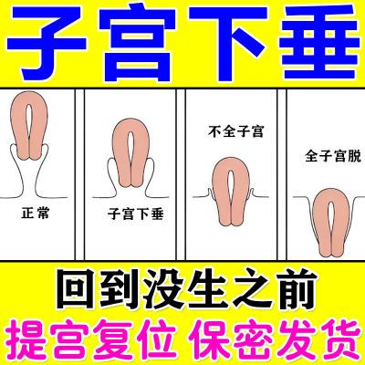 子宫下垂贴【猛提】阴道壁膨出产后下垂松弛尿频尿急小腹下坠胀痛