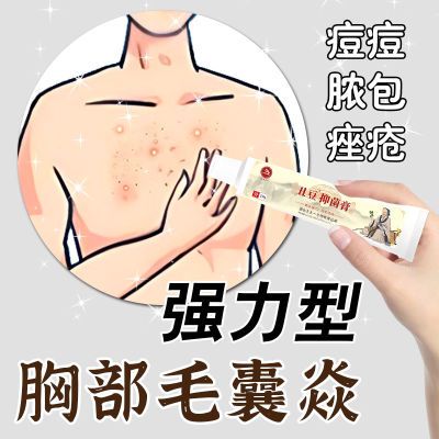 毛囊炎】前胸后背痘痘痤疮脓包头皮毛囊炎脂溢性皮炎红肿止痒膏y