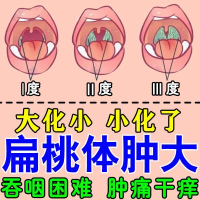 扁桃体肥大【正品】扁桃体发炎流涕咽喉肿痛吞咽困难呼吸不畅喷剂