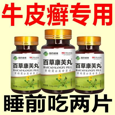 【国药品牌】牛皮藓瘙痒头藓股藓红斑红肿掉皮屑蒲公英甘草中药材