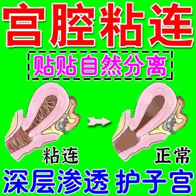 宫腔粘连小腹坠痛子宫内膜修复宫腔狭窄经期紊乱月经不调闭经专用