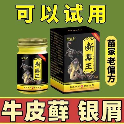 【牛皮癣专用药膏】银屑癣湿疹头癣体癣手足股癣皮肤瘙痒止痒王