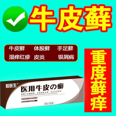 爆卖200w【医用牛皮癣银屑病】全身顽固头癣手足癣银屑股癣止痒膏