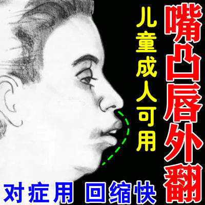 嘴凸唇外翻】嘴唇变薄变小腺样体肥大张嘴呼吸打呼鼻塞面容矫正贴