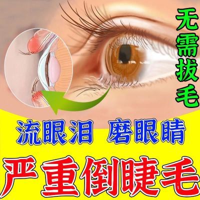 【不拔毛】倒睫毛磨眼睛眼睛畏光流泪上眼睑内翻睫毛倒长扎眼睛L