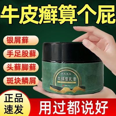 顽固牛皮癣专用药膏银屑病皮炎湿疹手癣头皮藓头癣全身可用止痒膏