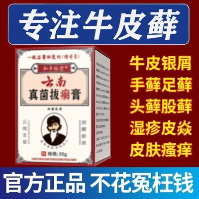 【严重银屑】全身顽固性牛皮癣头癣手足癣银屑股癣皮炎湿疹止痒膏