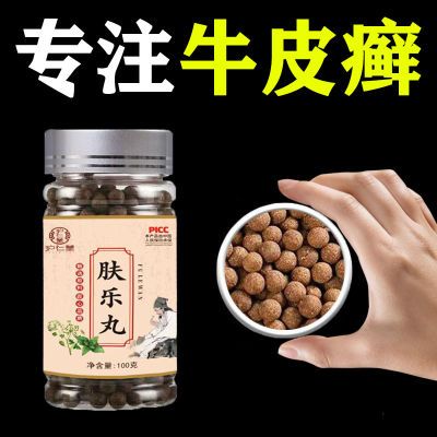 【家传秘方】银屑牛皮癣体股癣红斑正品栀子桃仁药食同源