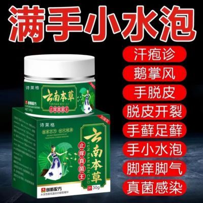 云南汗疱疹手上起小水泡手足藓真菌感染湿疹水泡手脚脱皮止痒药膏