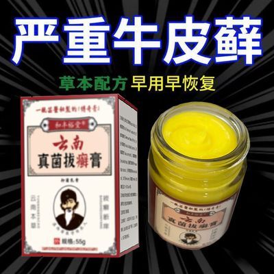 真菌拔癣膏牛皮癣银屑手足癣湿疹头癣体癣股癣皮肤瘙痒止痒草本膏